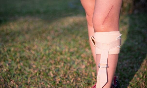 ոտքերի վերականգնում varicose veins- ի վիրահատությունից հետո